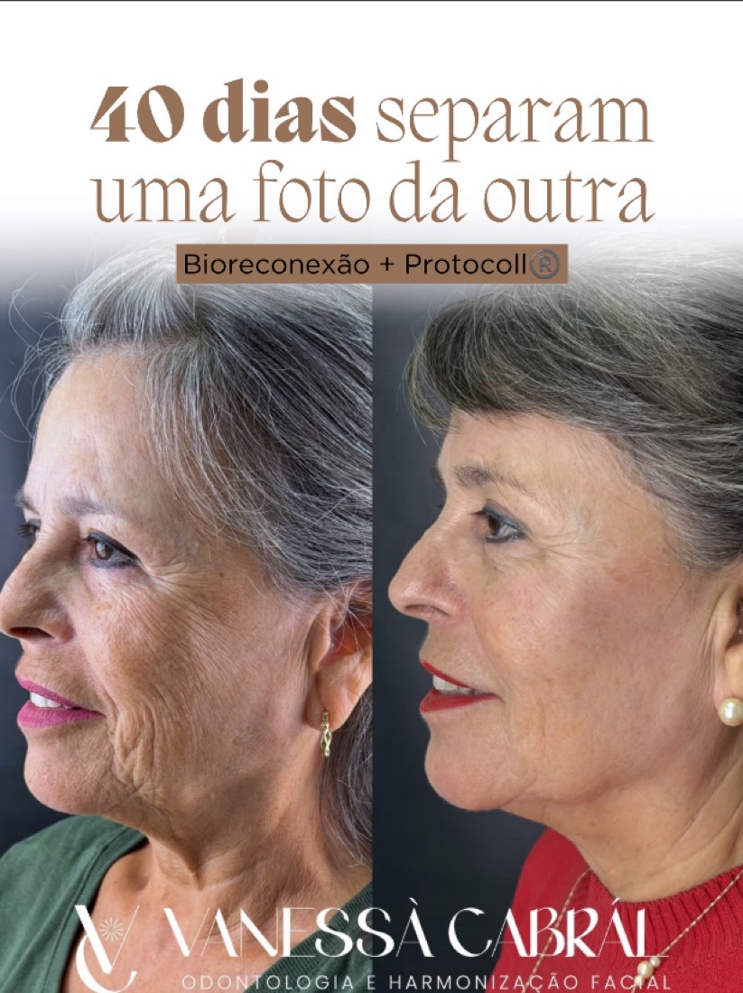 Antes e depois de 40 dias de tratamento com Bioreconexão e Protocoll